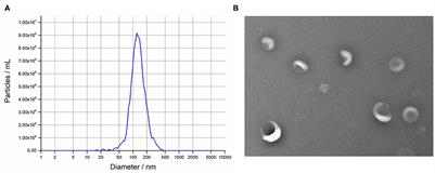 miRNA profiling in intrauterine exosomes of pregnant cattle on day 7